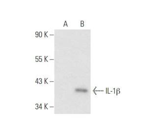 interleukin 1 beta|IL1B interleukin 1 beta [Homo sapiens (human)] .